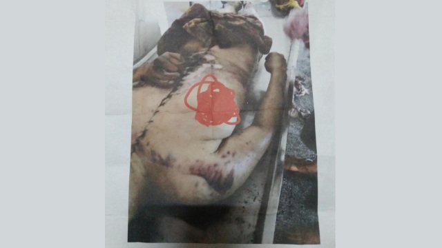 Dead Worker’s Organs Suspected Stolen