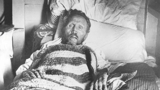 Father Damien on his deathbed. 