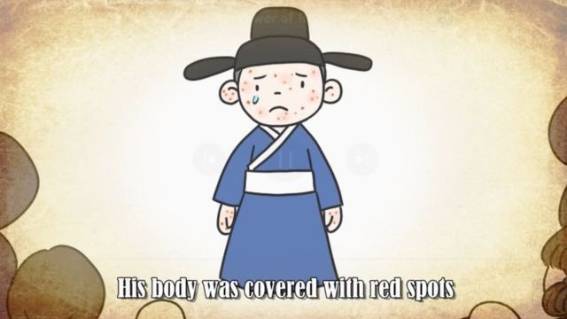 The second video: the young boy affected with leprosy.