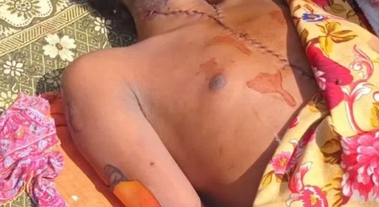 Masih’s injuries do not seem compatible with suicide. Source: National (Catholic) Commission for Justice and Peace, Pakistan.