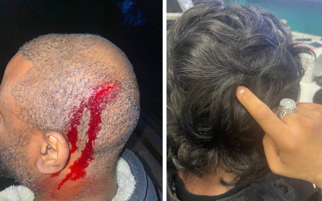 The Saga of AROPL: Racism, Riots, and Violence
